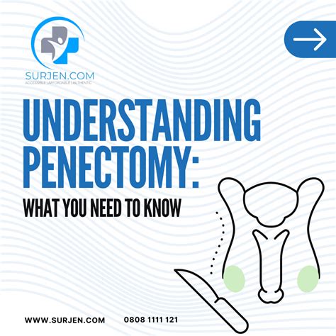 diy penectomy|Penectomy: Purpose, Procedure, Result.